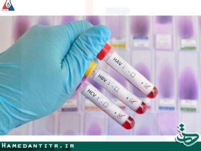 راه اندازی آزمایشات تشخیص مولکولی هپاتیت B , C در معاونت بهداشتی